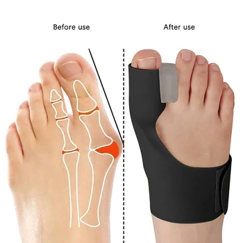 1 бр. Разделител за пръстите на краката, коректор вальгусной деформация на големия пръст на крака, Ортопед коректор на костите на палеца на крака, за Изправяне, за педикюрных чорапи.